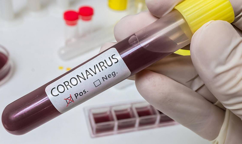 Já são três os casos suspeitos de coronavírus em Muriaé
