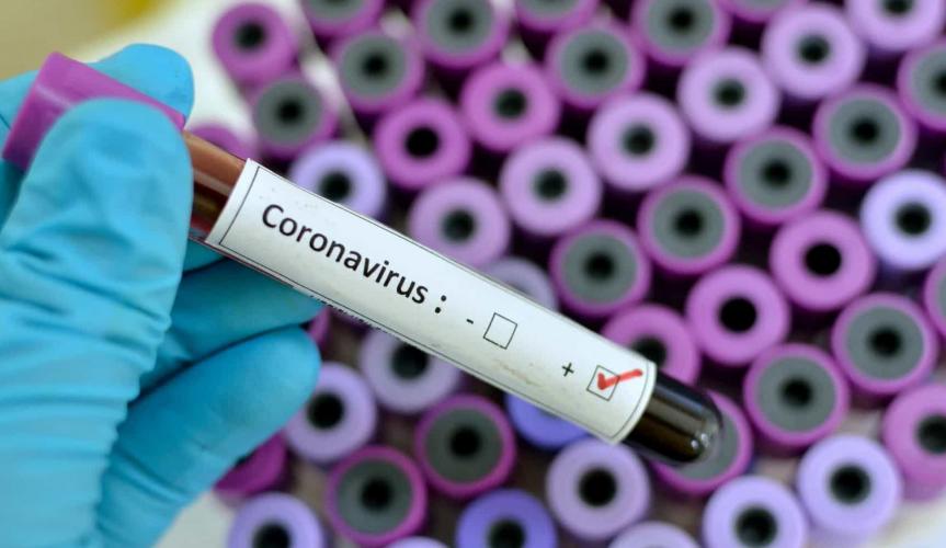 Cartilha orienta sobre prevenção ao novo Coronavírus