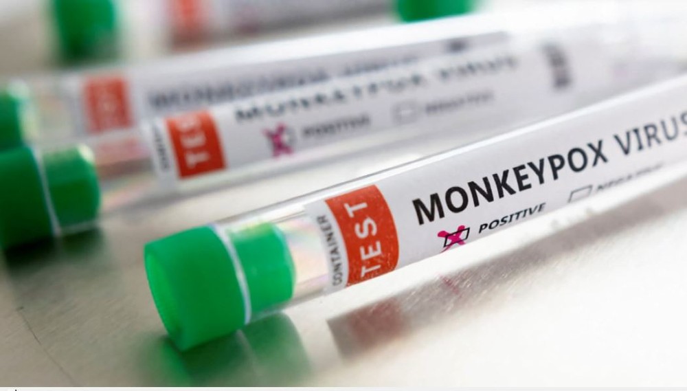Muriaé registra primeiro caso suspeito de varíola dos macacos