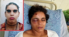 Vera Lúcia no Hospital e no detalhe: vítima do ex-companheiro